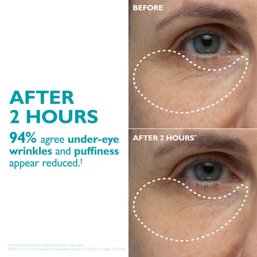 Peptiject Peptide Infused Face + Eye Tape