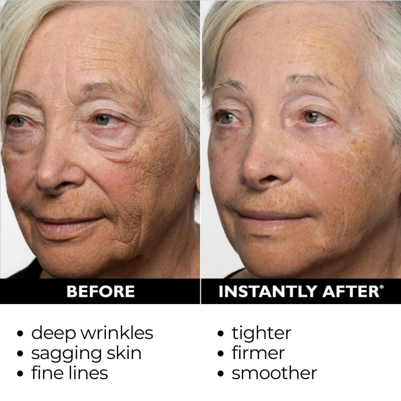 ElastiSkin Temporary Face Tightener 100ML