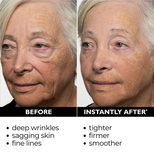 ElastiSkin Temporary Face Tightener 100ML