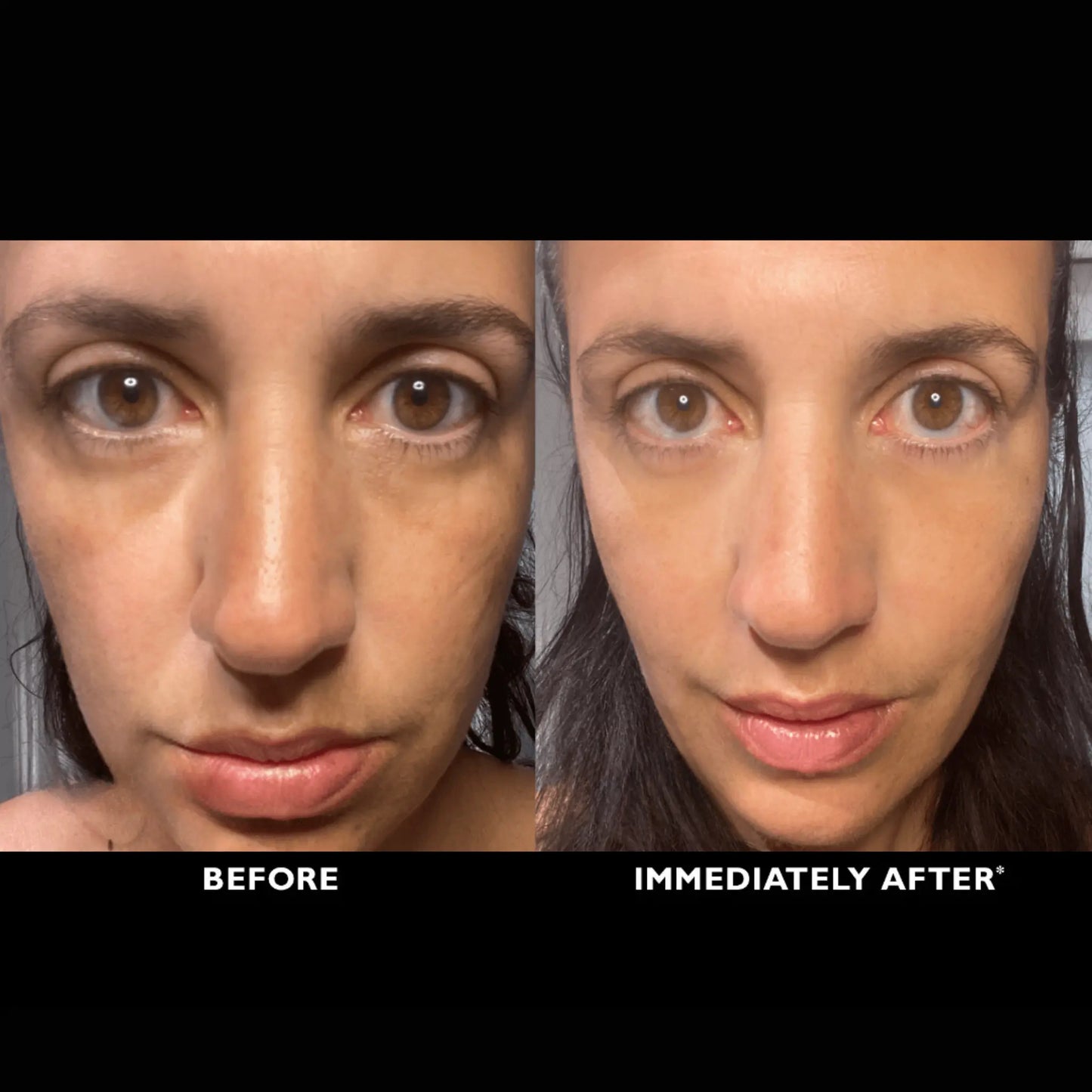 ElastiSkin Temporary Face Tightener 100ML