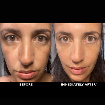 ElastiSkin Temporary Face Tightener 100ML