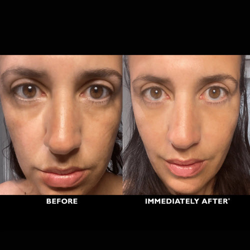 ElastiSkin Temporary Face Tightener 100ML