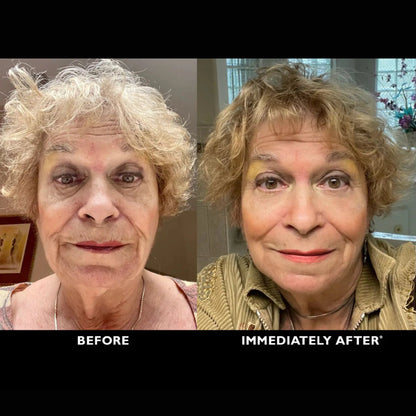 ElastiSkin Temporary Face Tightener 100ML