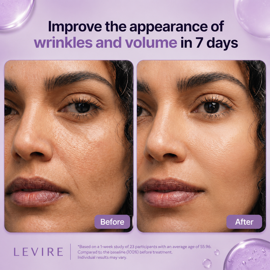 Levire Facial Volufiline Therapy