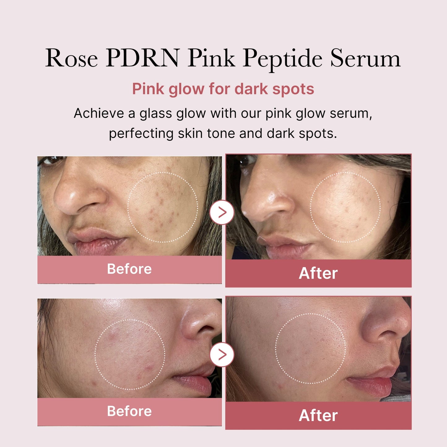 PDRN Rose Glow Serum