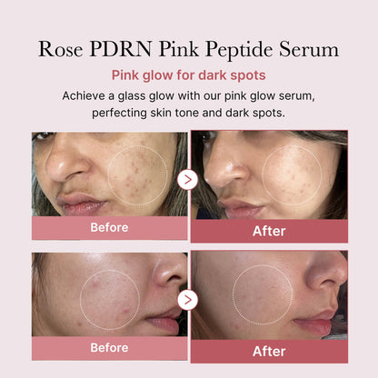 PDRN Rose Glow Serum