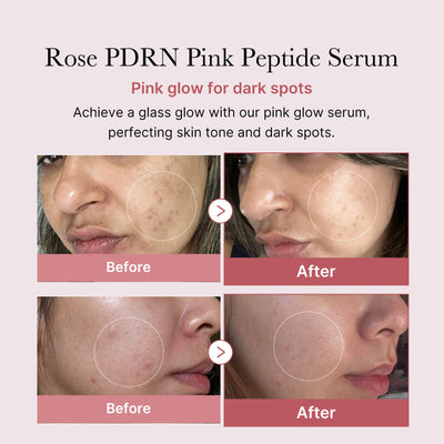 PDRN Rose Glow Serum