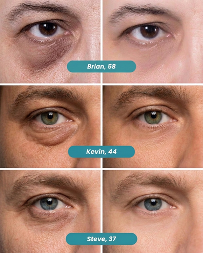 Peptiject Peptide Infused Face + Eye Tape