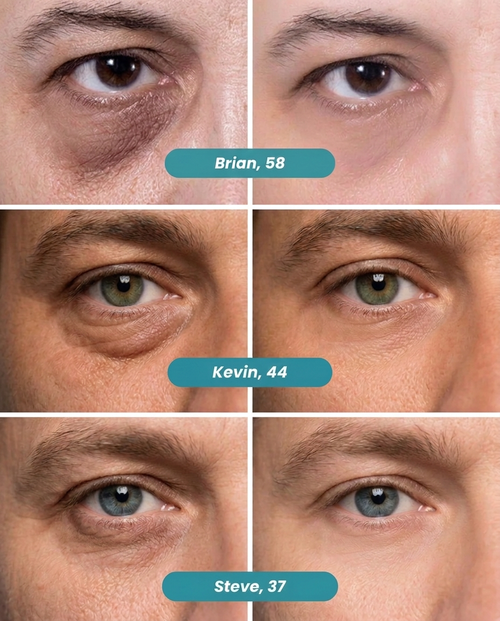 Peptiject Peptide Infused Face + Eye Tape